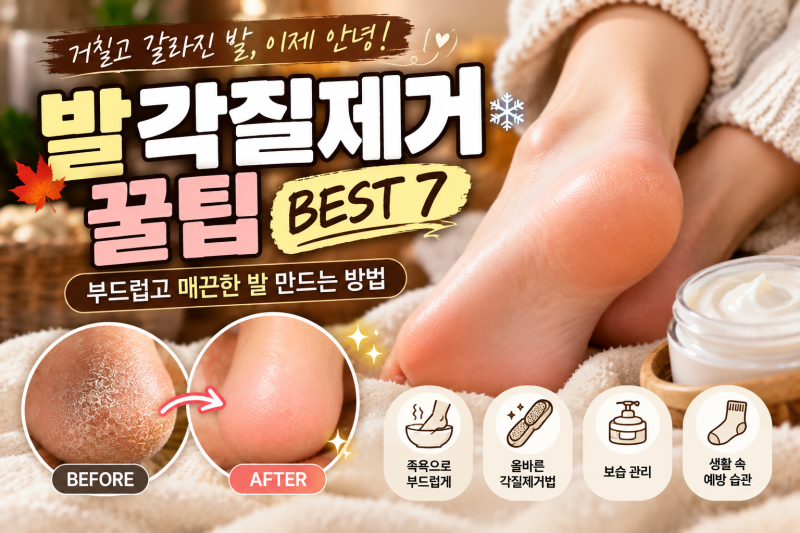 발각질제거 꿀팁 BEST 7｜발뒤꿈치 굳은살 제거부터 겨울철 발 관리까지!