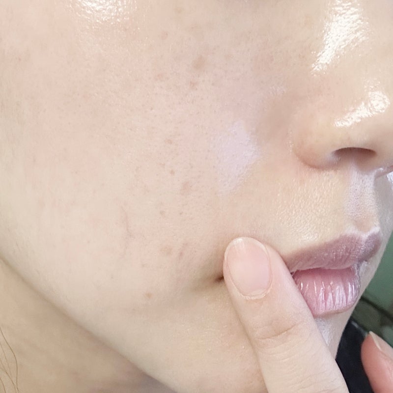 괜히 비싼 것부터 샀네요,, 기미제거 이걸 먼저 알았어야 했는데