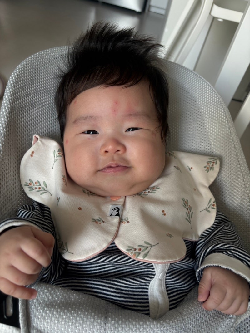 아기 모기 물렸을 때 안 붓는 이유?｜증상·대처법·병원 가야 하는 경우
