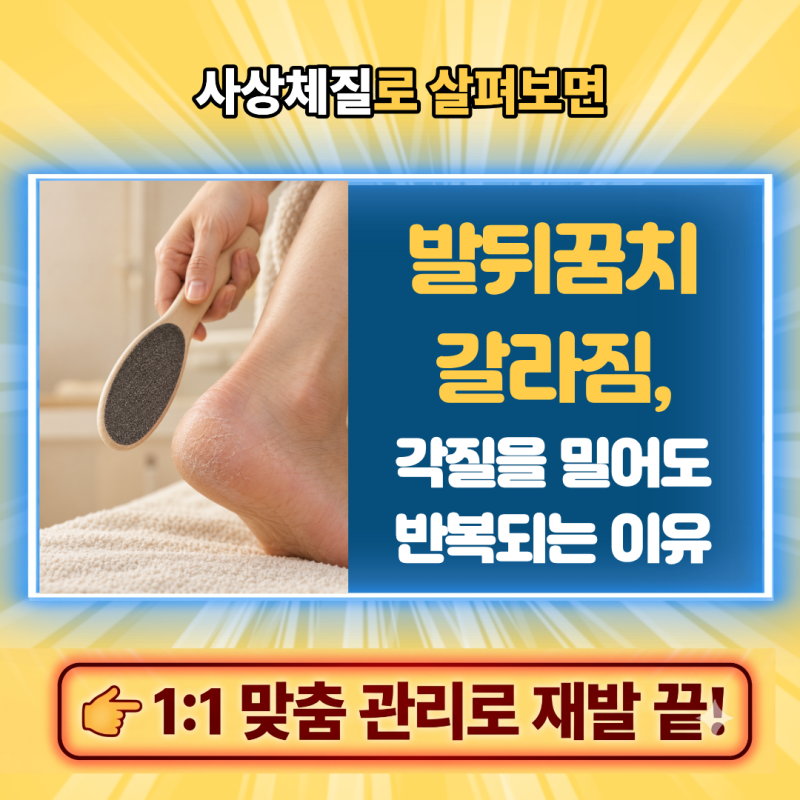 발뒤꿈치 갈라짐, 각질을 밀어도 반복되는 이유