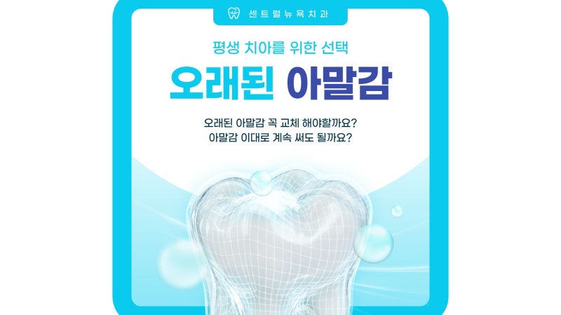 오래된 아말감, 아말감 교체