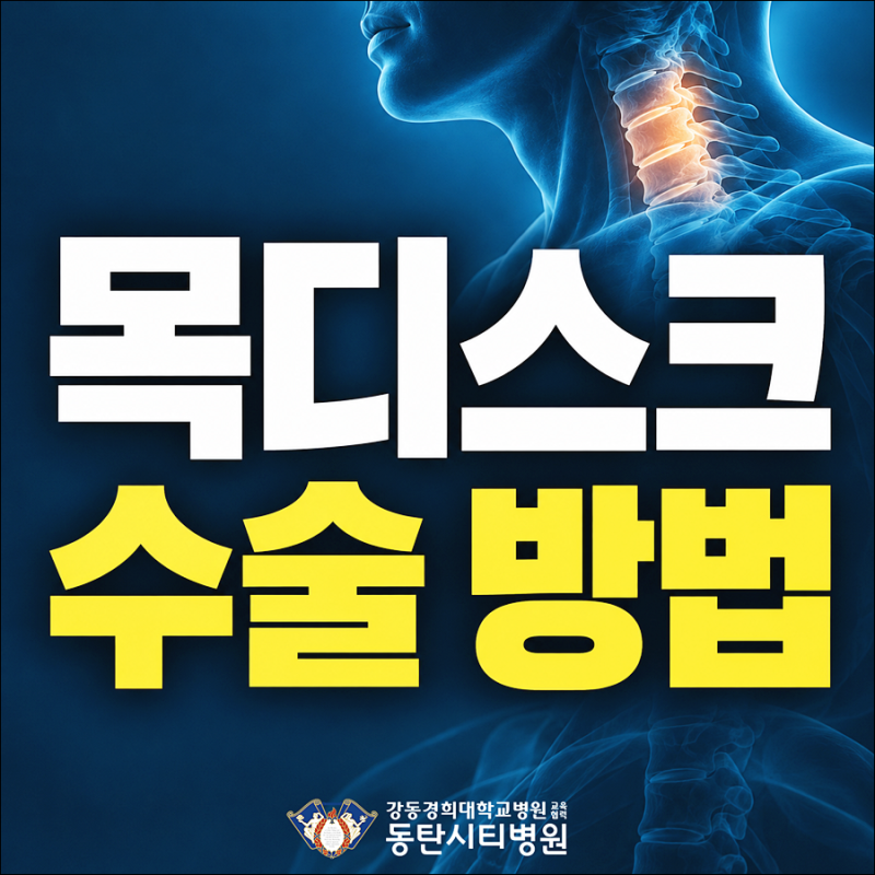 목디스크 수술 방법, 경추유합술 ACDF는 언제 고려할까요?