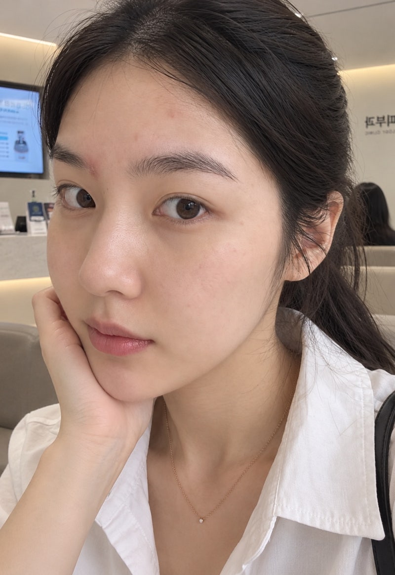 아픈 왕여드름, 염증주사 진짜 효과 있을까? 찐후기