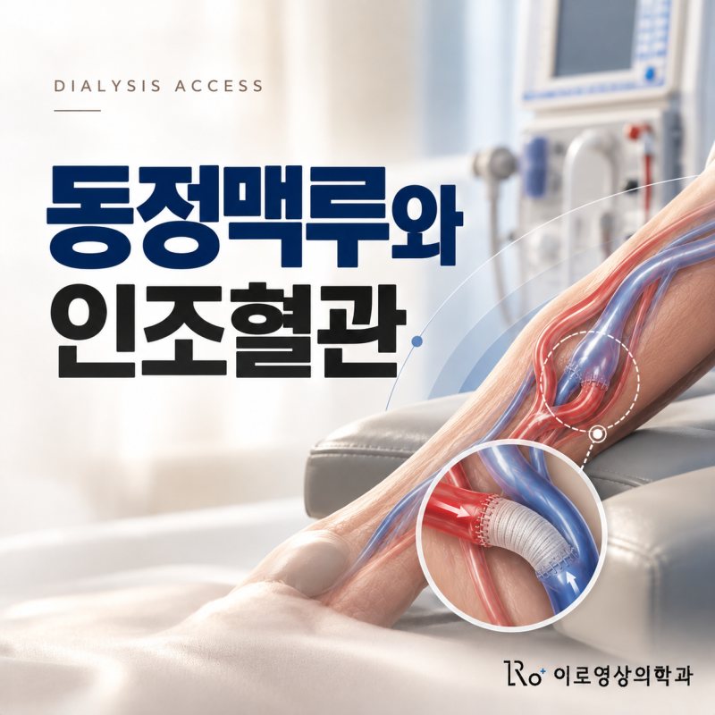 투석을 앞두고 있습니다 | 동정맥루와 인조혈관, 무엇을 기준으로 정하고 언제부터 쓸 수 있....