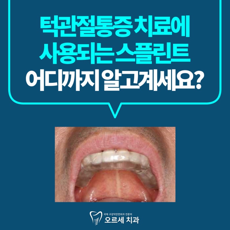 턱관절 통증 치료에 쓰는 스플린트는 한 가지가 아닙니다