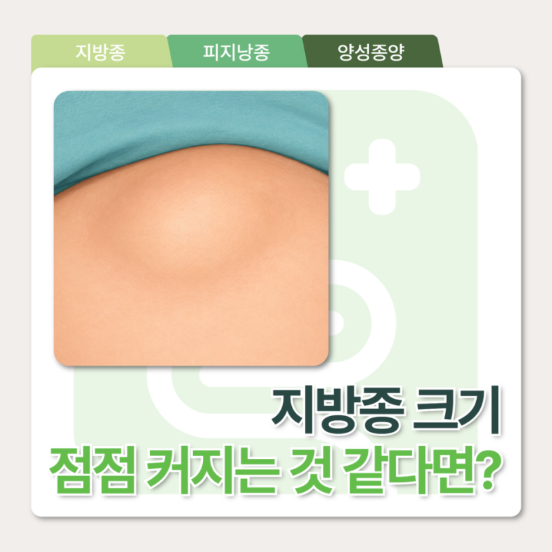 천안지방종 크기가 점점 커지고 있다면 어떻게 해야 할까요?