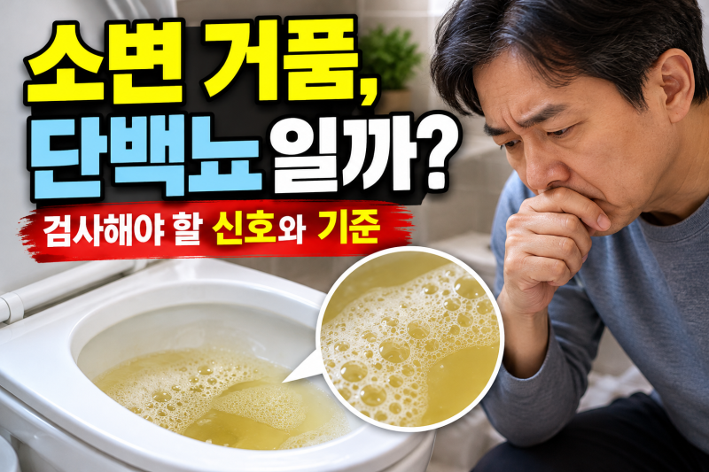 소변 거품이 계속 생긴다면? 단백뇨 의심 신호 3가지