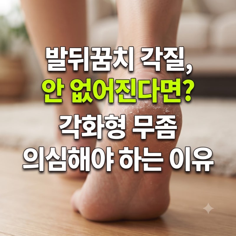 발뒤꿈치 각질이 안 없어진다면? 단순 건조증이 아닌 각화형 무좀 의심해야 하는 이유