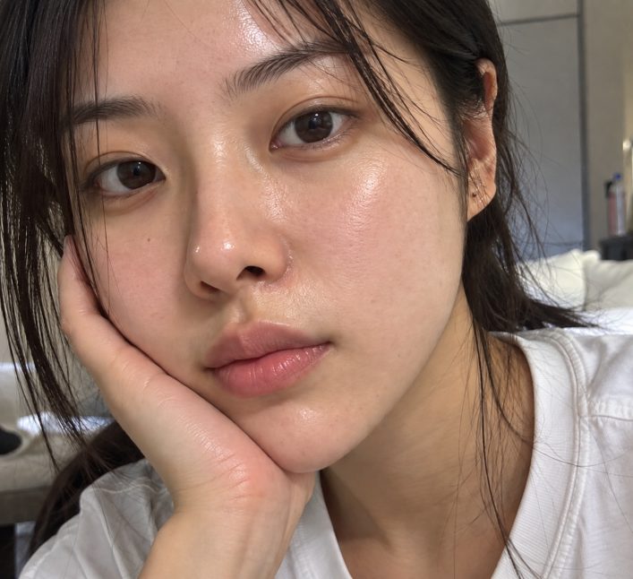 디페린겔 여드름패치 써도 반복되는피부트러블 성인여드름엔?