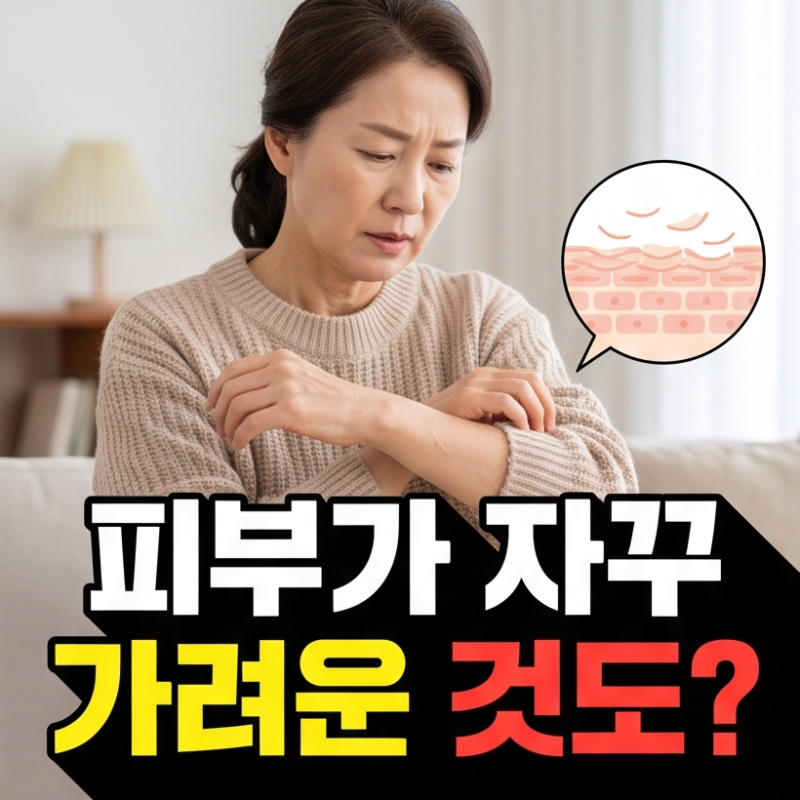 "피부가 자꾸 가려운 것도?" 갱년기 증상 가려움 알아보기