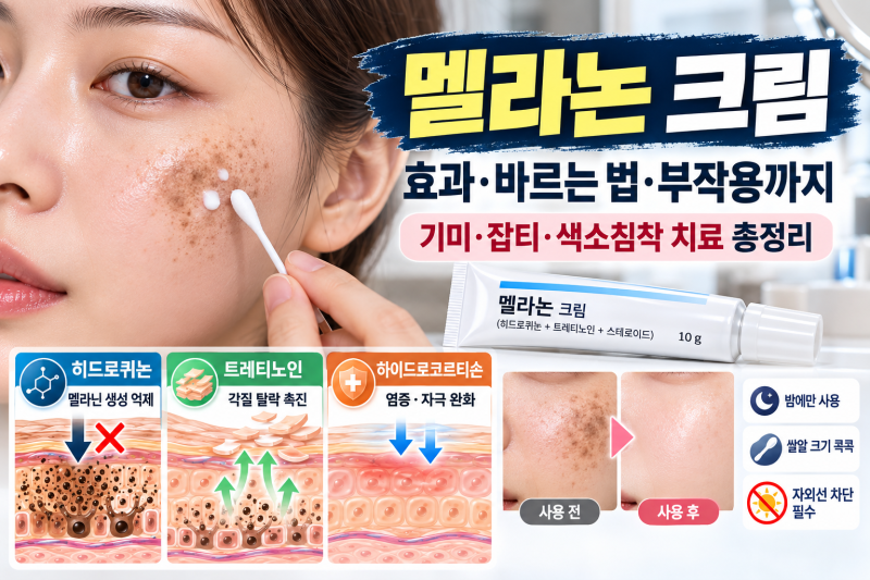 짙은 기미와 잡티를 잡는 멜라논 크림! 올바른 사용법 & 주의사항 및 부작용 완벽 정리