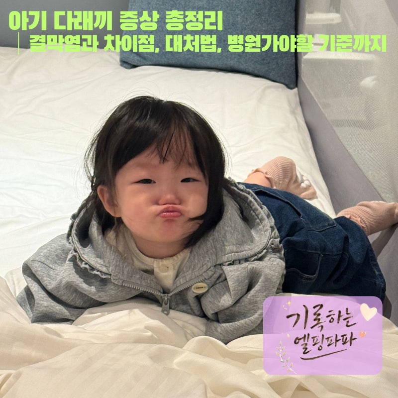 아기 다래끼 증상 총정리｜결막염과 차이점, 대처법, 병원가야할 기준까지