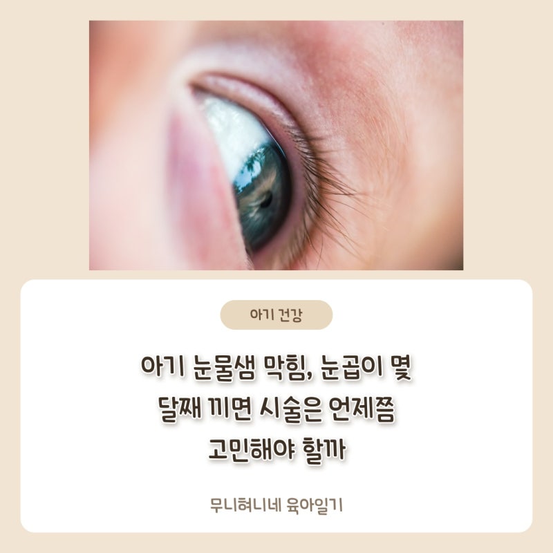 아기 눈물샘 막힘, 눈곱이 몇 달째 끼면 시술은 언제쯤 고민해야 할까