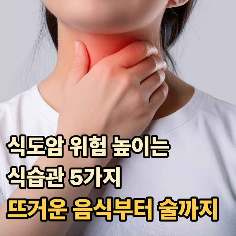 식도암 위험 높이는 식습관 5가지...뜨거운 음식부터 술까지