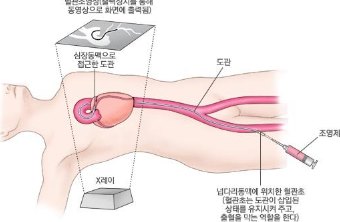 심혈관 조영술, 검사 방법부터 비용·주의사항까지 총정리