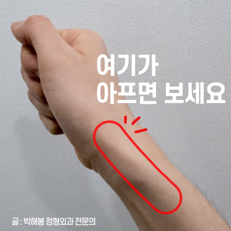 엄지손가락 통증 (손목뼈 통증과 정형외과 병원 치료)