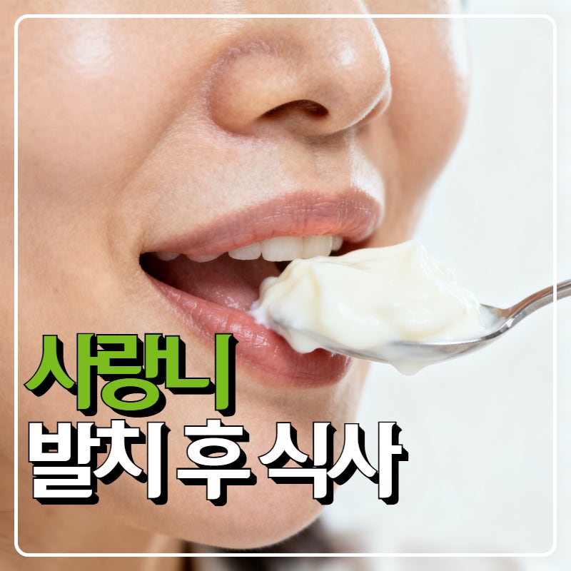 사랑니발치후식사 언제부터? 흡연·빨대·양치 조심해야 하는 이유