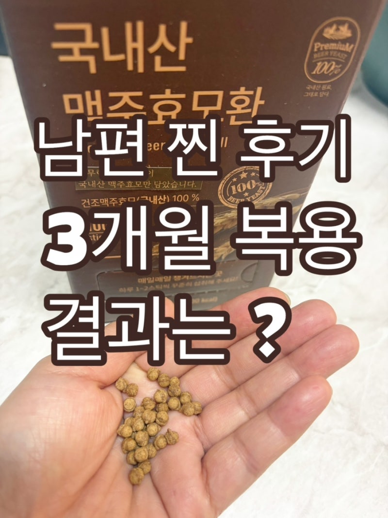[남편 찐후기] 탈모 고민일 때 맥주효모 추천 ! 라이프힐 맥주효모환 3개월 복용 후 결과는?