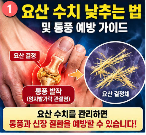 요산 수치 낮추는 법, 엄지발가락 통풍 전조증상 막는 퓨린 식단 꿀팁