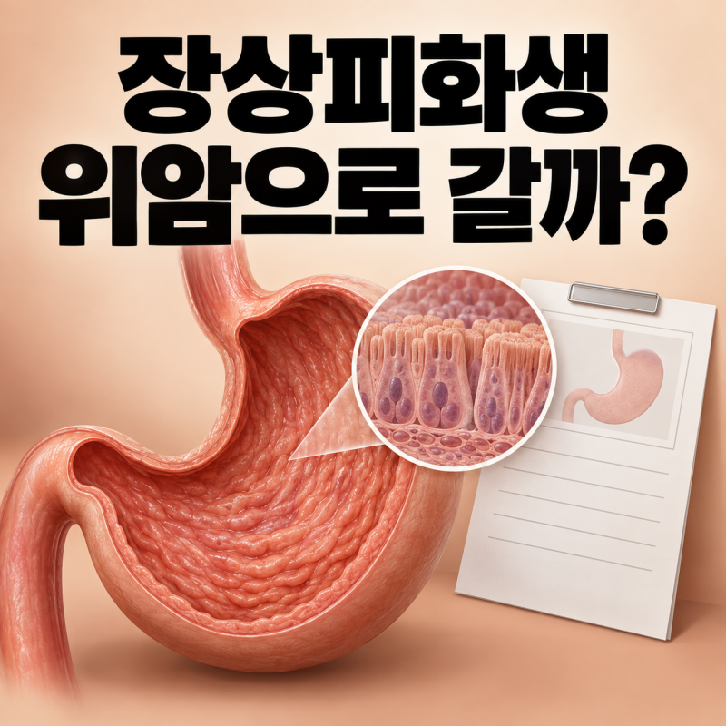 위내시경 장상피화생, 위암으로 진행할까?