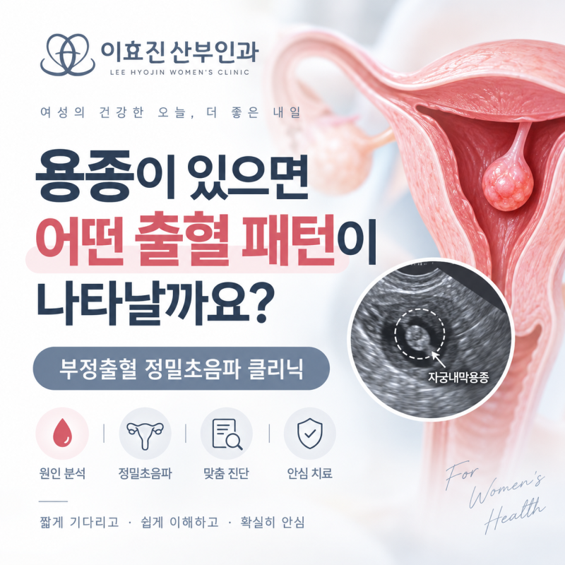 흑석동 산부인과 자궁내막용종이 있으면 어떤 출혈 패턴이 나타날까요?