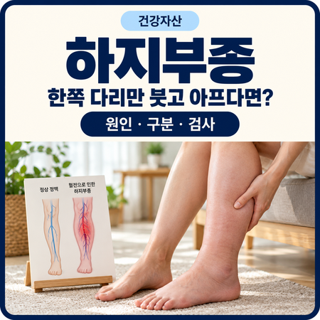 다리 부종 원인, 한쪽만 붓는다면 먼저 확인할 신호 3가지