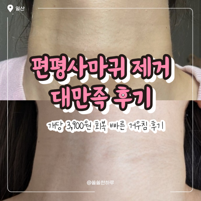 일산 편평사마귀 | 메디폼 안 붙이는 거우침으로 250개 제거 대만족 후기 (가격, 경과)