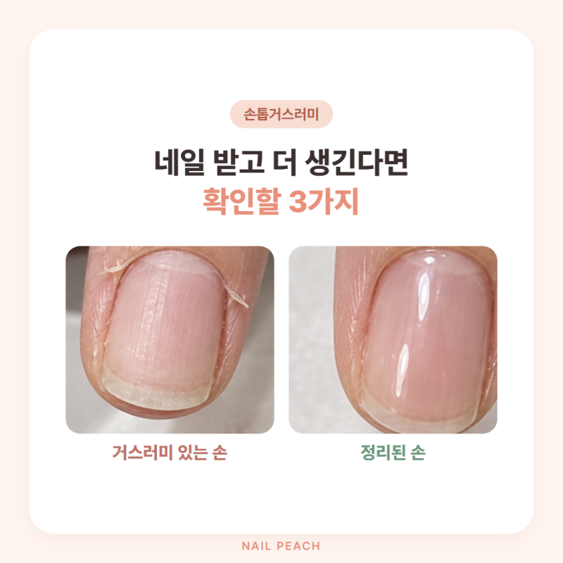손톱거스러미, 네일 받고 더 생긴다면 확인할 3가지