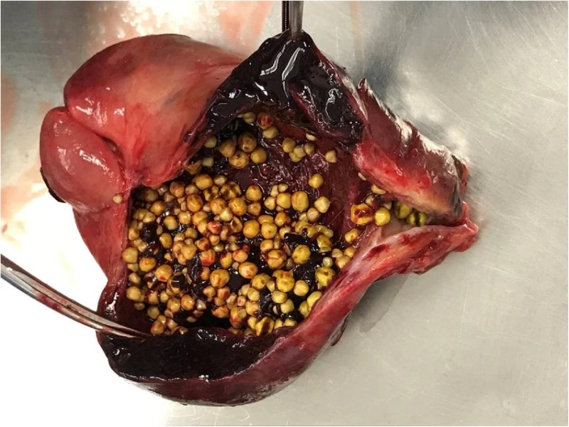 담석증 Gallolithiasis·담낭염 Cholecystitis: 담석증·담낭염 의료진·의료기관 병원 플랫폼