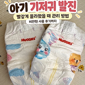 아기 기저귀 발진 빨갛게 올라왔을 때｜비판텐 연고 사용과 관리 방법