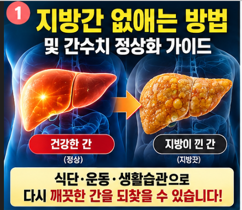 지방간 없애는 방법, 피로감과 간수치(AST ALT) 정상으로 낮추는 식단 운동법