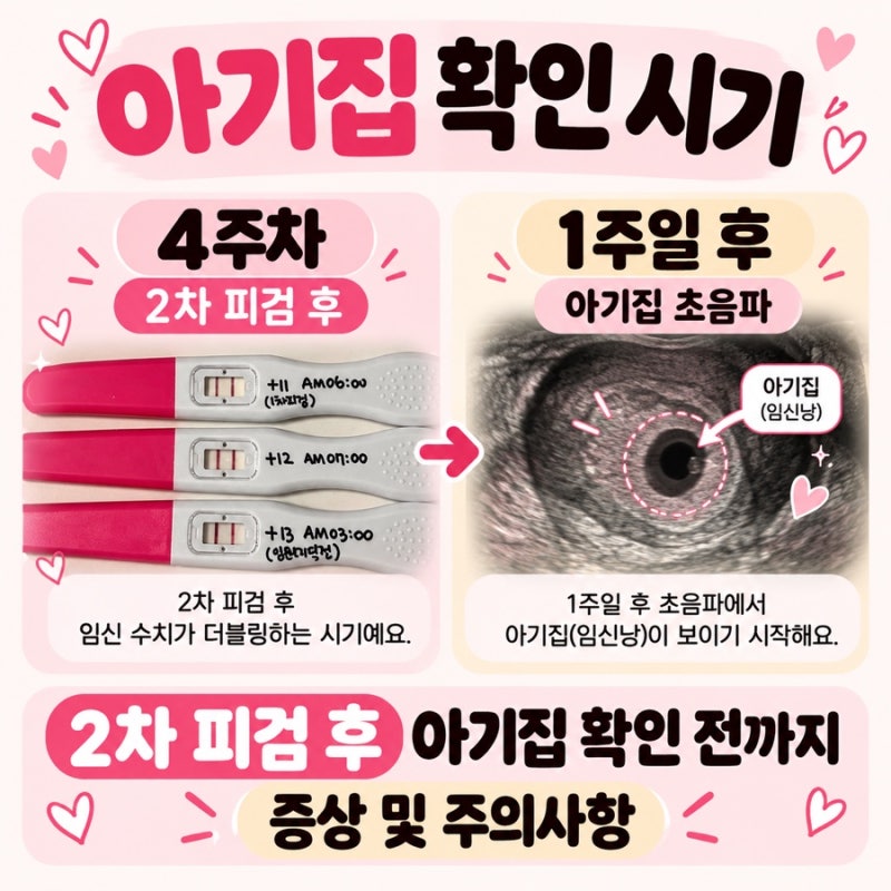 시험관 2차 피검사 이후 임신4주차 증상｜아기집 확인 시기 음식 운동 주의사항