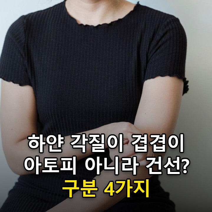 건선 증상, 아토피와 구분하는 법과 전염되지 않는 만성 피부병 관리 순서