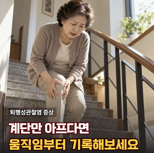 "계단만 내려가면 왜 무릎이 욱신하지?" 퇴행성관절염 증상 쉬기보다 먼저 볼 변화