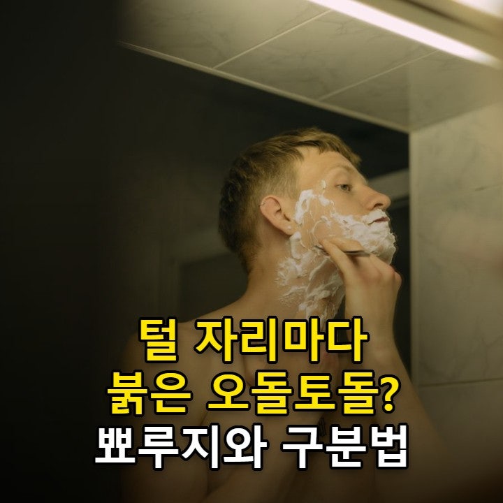 모낭염 원인, 뾰루지와 헷갈리는 붉은 오돌토돌 구분법과 관리