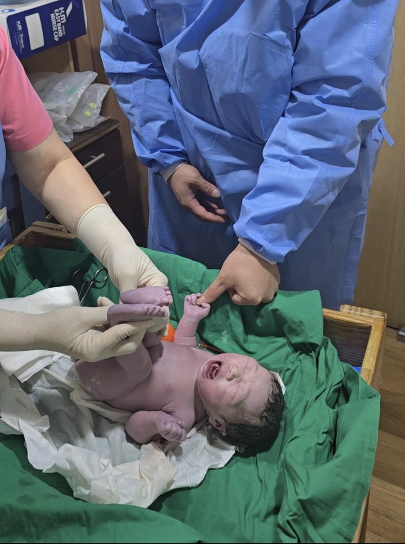 아이제일산부인과 제왕절개 출산 후기 기록 ~3일차!