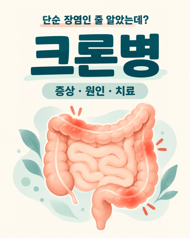 윤종신도 앓는 크론병, 단순 장염인 줄 알았는데?｜증상·원인·완치 여부