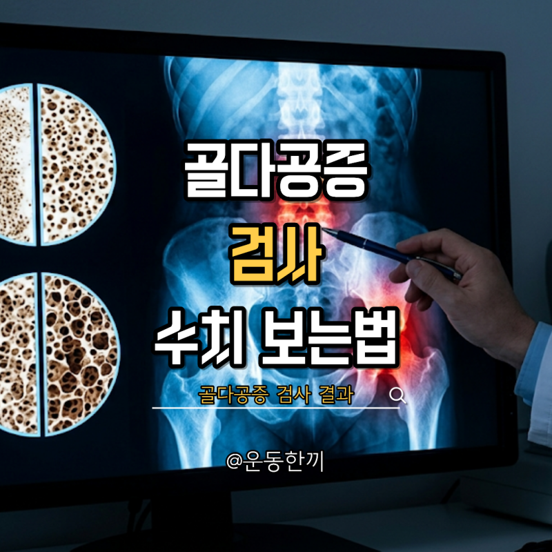 골다공증 검사, 언제 받아야 할까? 골밀도 검사 방법과 수치 보는 법