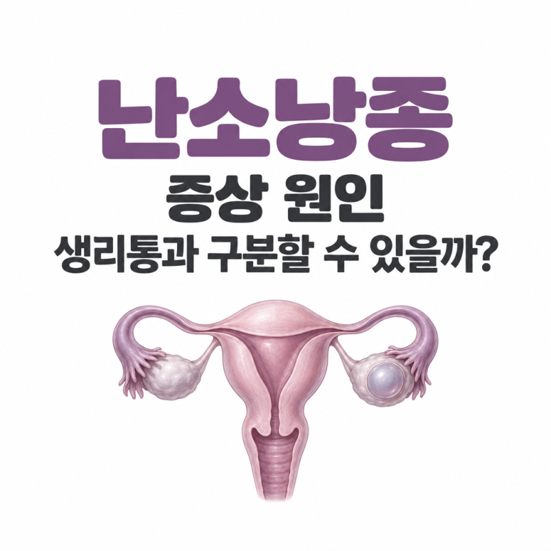 난소낭종 증상 원인, 생리통과 구분할 수 있을까?