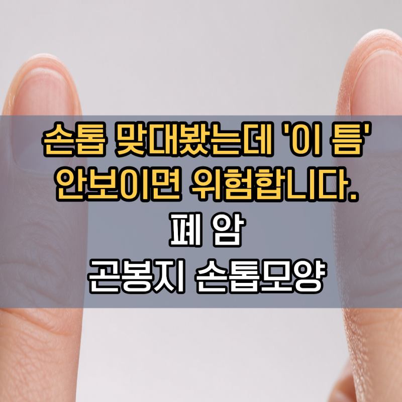 "손톱 맞대봤는데 '이 틈' 안 보이면 위험합니다" 놓치기 쉬운 폐암증상 | 곤봉지 샴로스창검....