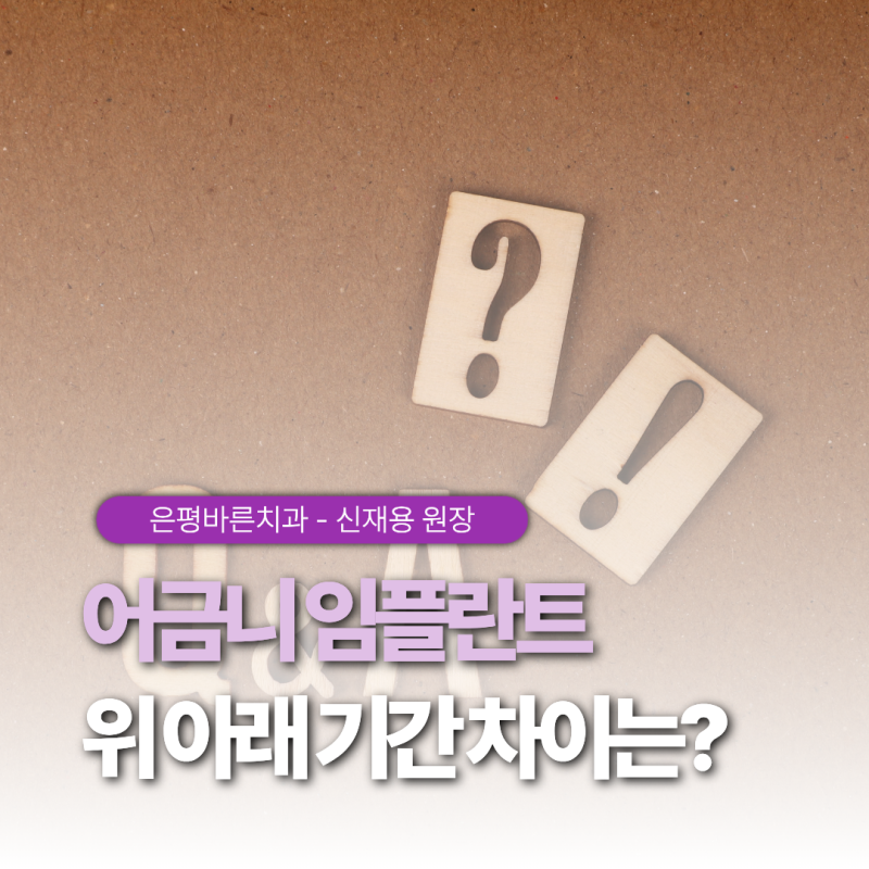 [2편] 어금니 임플란트 완성까지 몇 달 걸릴까? (상악 vs 하악 기간 차이)