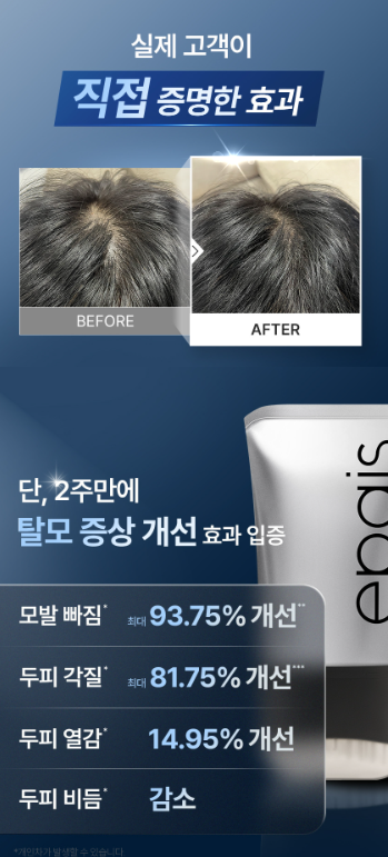 에이페 스칼프 부스팅 앰플 EX 한달 사용후기 - 1+1 광고 보고 직접 구매한 내돈내산 솔직리뷰