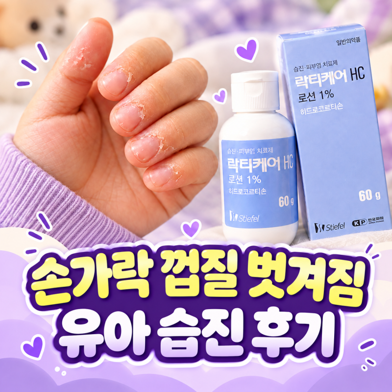 땀 많은 아이 손가락 껍질 벗겨짐, 유아습진일까? 락티케어 HC 1% 후기