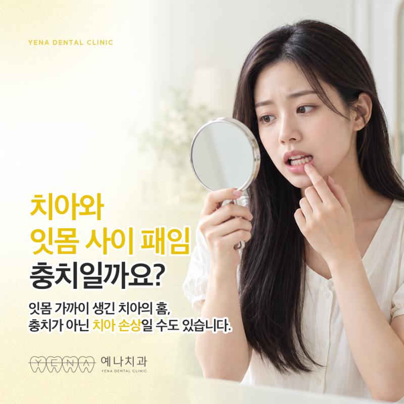잇몸 가까이 치아가 패이고 시린데, 충치일까요?