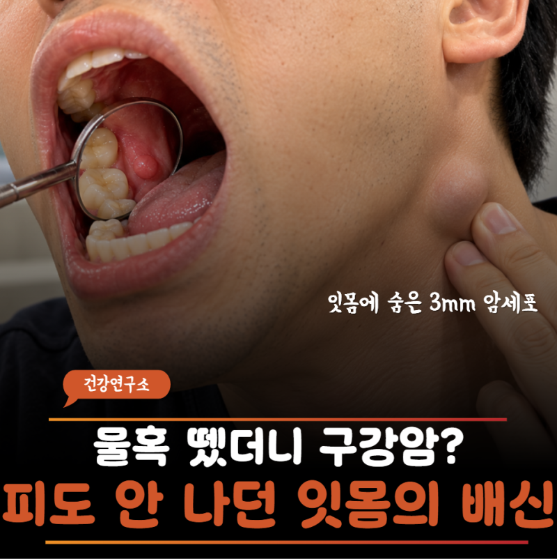 “목에 생긴 물혹 떼러 갔더 구강암이라네요…” 잇몸 뒤에 숨어있던 3mm 암의 소름 돋는 정....