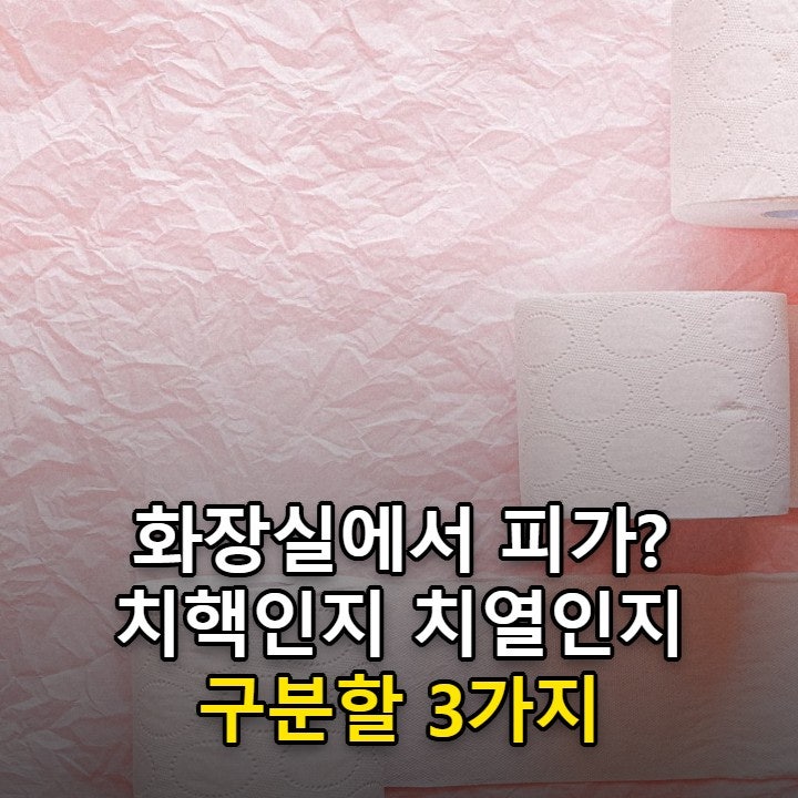 치질 증상, 피가 묻어 나오거나 찢어지듯 아플 때 구분할 3가지