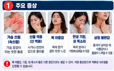 역류성 식도염 증상과 치료 방법, 속쓰림·목 이물감 원인 총정리