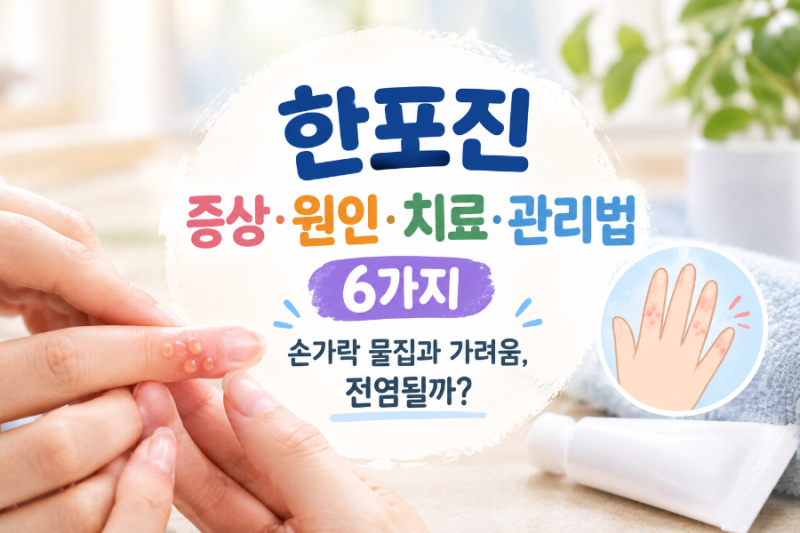 한포진 증상·원인·치료ㆍ관리법 6가지, 손가락 물집과 가려움, 전염될까?
