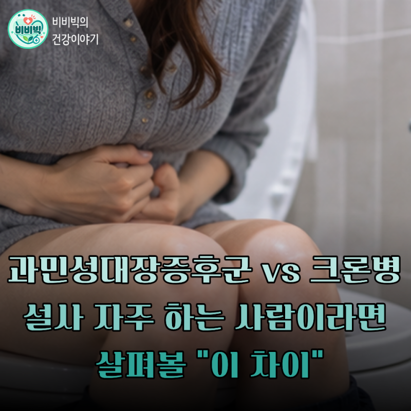 과민성대장증후군 vs 크론병… 설사 자주 하는 사람이라면 살펴볼 "이 차이"