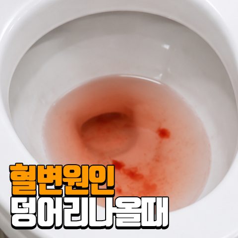 지나치면 위험한 혈변 원인과 덩어리가 보이는 이유